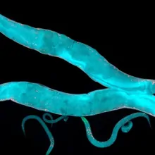 Caenorhabditis elegans, a free-living transparent nematode (roundworm), about 1 mm in length.